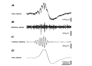 high frequency ripple wave